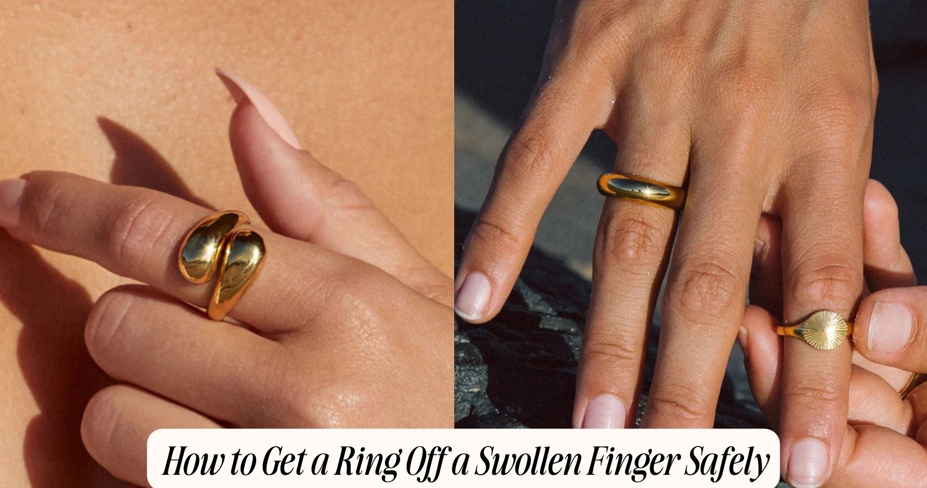 how get a ring off a swollen finger