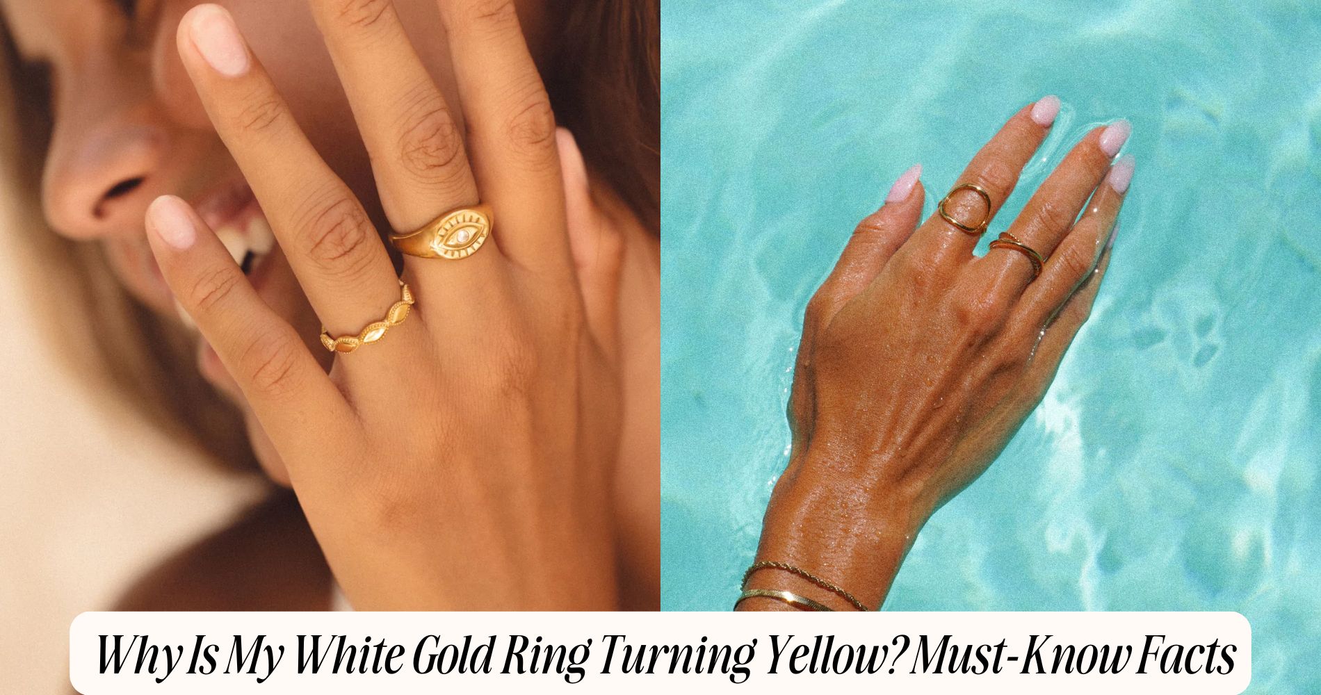 why is my white gold ring turning yellow